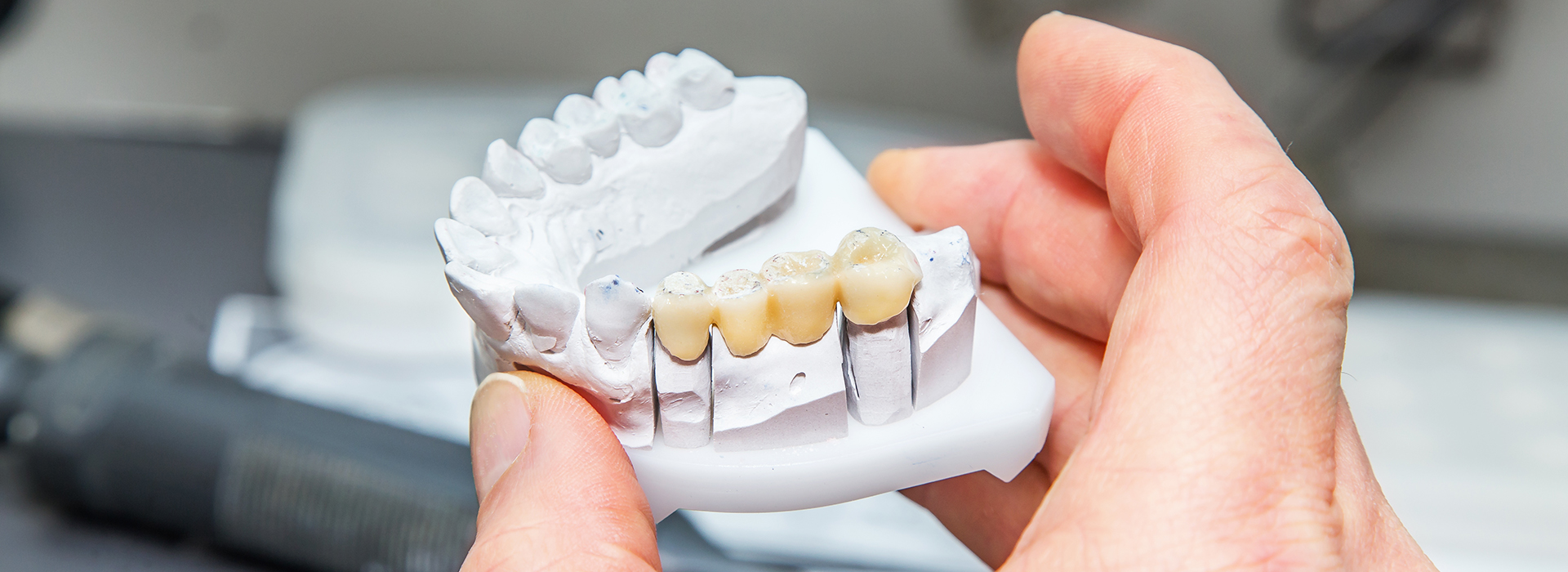 Steven R. Feigelson, DDS | Root Canal Therapy, Oral Exams and Bridges   Dentures