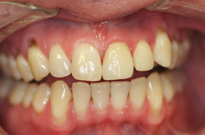 Best Dentist in Commack