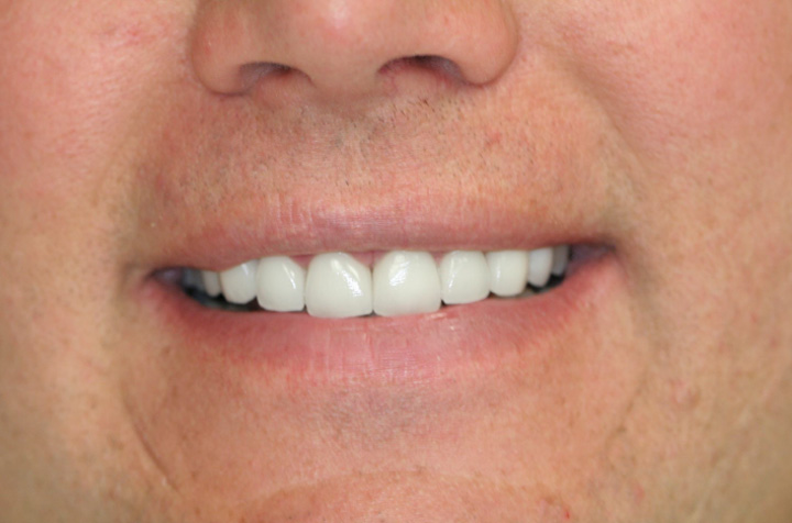 Best Dentist in Commack