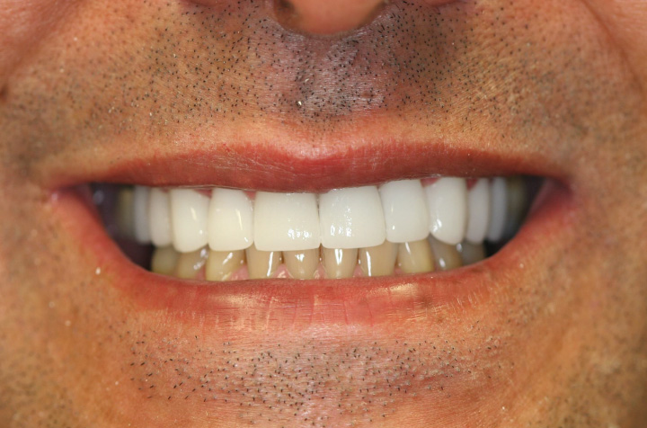 Cosmetic Dentist in Commack