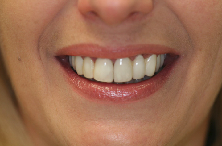 Cosmetic Dentist in Commack