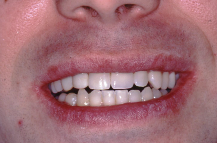 Cosmetic Dentist in Commack