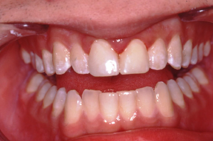 Cosmetic Dentist in Commack