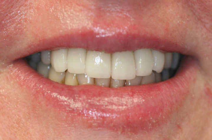 Cosmetic Dentist in Commack