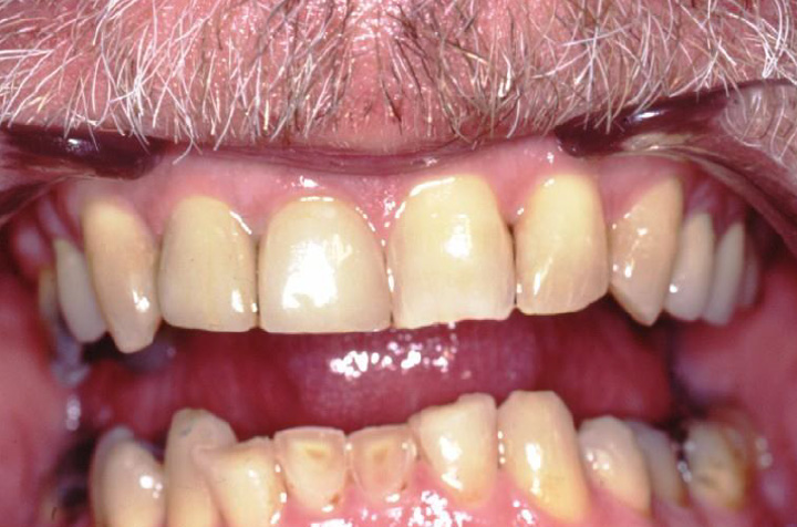 Best Dentist in Commack