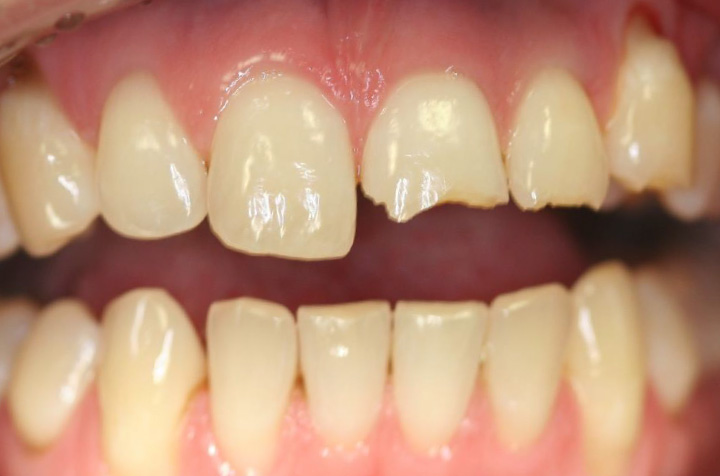 Best Dentist in Commack