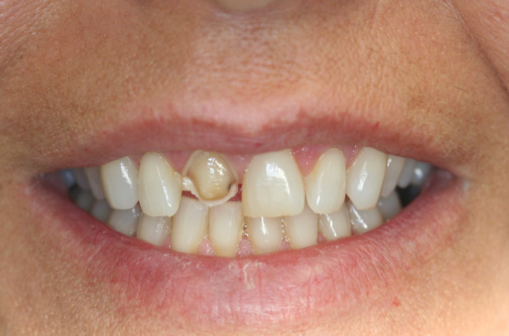 Best Dentist in Commack