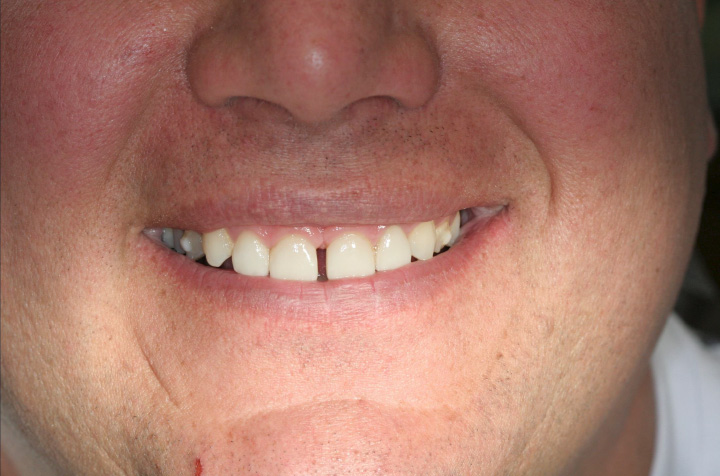 Cosmetic Dentist in Commack