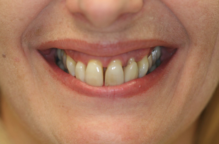 Cosmetic Dentist in Commack