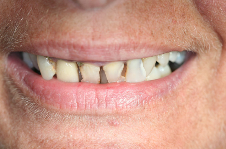 Cosmetic Dentist in Commack