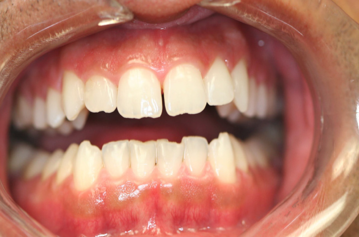 Best Dentist in Commack