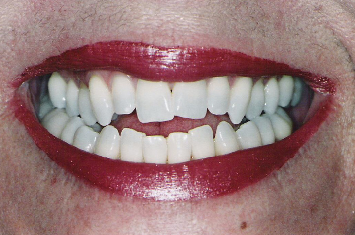 Best Dentist in Commack