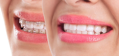 Steven R. Feigelson, DDS | Oral Exams, CAD CAM Technology and Veneers