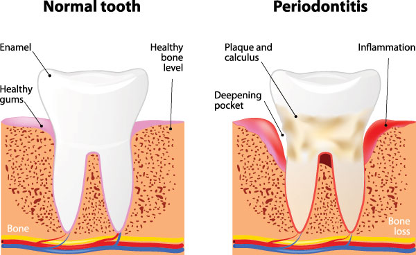 Steven R. Feigelson, DDS | Pediatric Dental Care, Root Canal Therapy and Teeth Whitening