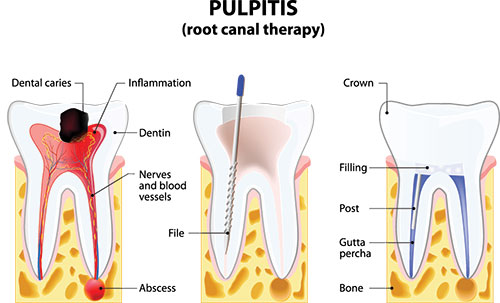 Steven R. Feigelson, DDS | Root Canal Therapy, Preventative Program and Pediatric Dental Care